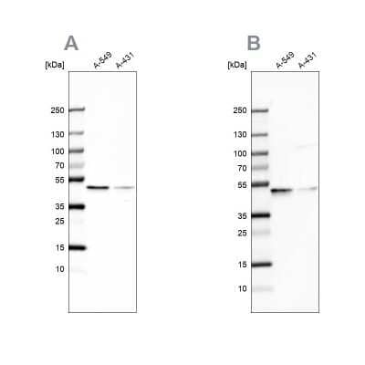 <b>Independent Antibodies Validation. </b>Western Blot: EPHX1 Antibody [NBP2-38594] - Analysis using Anti-EPHX1 antibody NBP2-38594 (A) shows similar pattern to independent antibody NBP1-83969 (B).