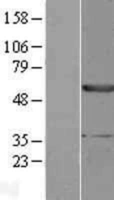 Western Blot EPHX1 Overexpression Lysate