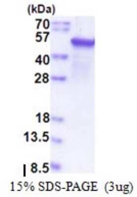 SDS-Page: Recombinant Human EPHX1 Protein [NBP2-51575] - 15% SDS Page (3 ug)