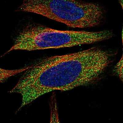 Immunocytochemistry/Immunofluorescence: EPHX2 Antibody [NBP1-89534] - Immunofluorescent staining of human cell line U-2 OS shows localization to cytosol.