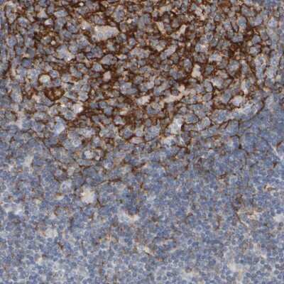 Immunohistochemistry-Paraffin: EPHX2 Antibody [NBP1-89531] - Staining of human lymph node shows moderate cytoplasmic positivity in germinal centers.