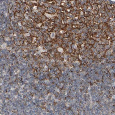 Immunohistochemistry-Paraffin: EPHX2 Antibody [NBP1-89534] - Staining of human lymph node shows moderate cytoplasmic positivity in germinal centers.