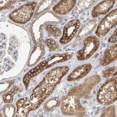 Immunohistochemistry-Paraffin: EPHX2 Antibody [NBP1-89534] - Staining of human kidney shows strong cytoplasmic positivity in cells in tubules.