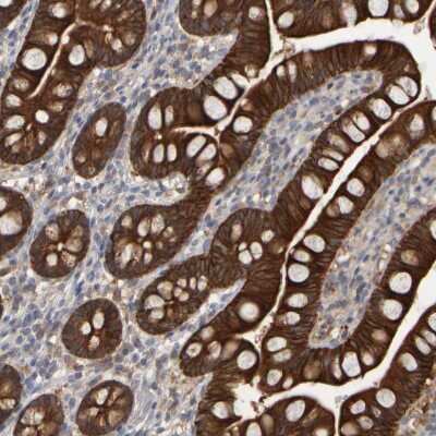 Immunohistochemistry-Paraffin: EPHX2 Antibody [NBP1-89534] - Staining of human small intestine shows strong cytoplasmic positivity in glandular cells.