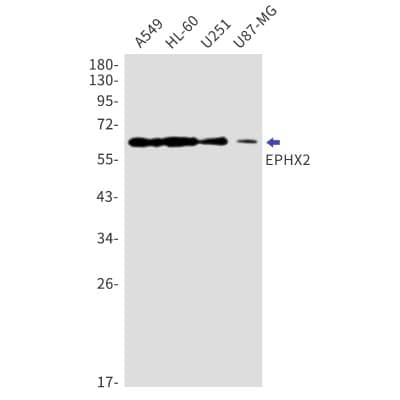 Western Blot: EPHX2 Antibody (S04-2F6) [NBP3-19986] - Western blot detection of EPHX2 in A549, HL-60, U251, U87-MG cell lysates using NBP3-19986 (1:1000 diluted). Predicted band size: 63kDa. Observed band size: 63kDa.