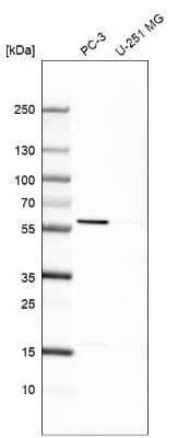 Western Blot EPHX2 Antibody