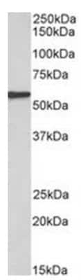 Western Blot: EPHX2 Antibody [NBP2-44321] - Analysis of of Human Kidney lysate (35ug protein in RIPA buffer).