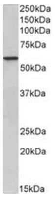 Western Blot: EPHX2 Antibody [NBP2-44322] - Analysis of of Human Kidney lysate (35ug protein in RIPA buffer).