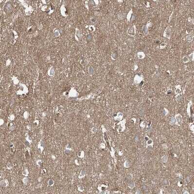 Immunohistochemistry-Paraffin: EPHX4 Antibody [NBP1-89307] - Staining of human cerebral cortex shows strong cytoplasmic positivity in neurons.