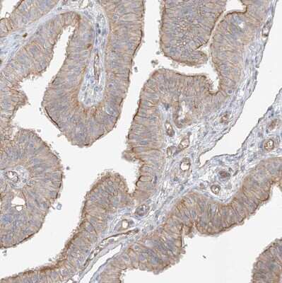 Immunohistochemistry-Paraffin: EPHX4 Antibody [NBP1-89307] - Staining of human fallopian tube shows moderate membranous positivity in glandular cells.