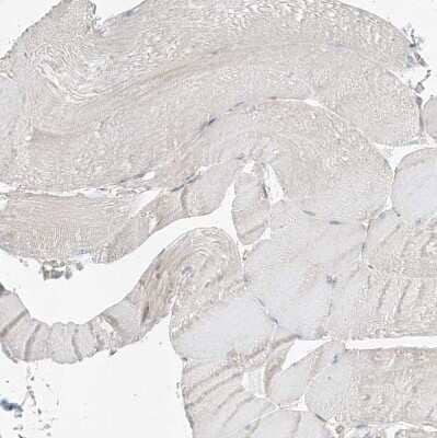 Immunohistochemistry-Paraffin: EPHX4 Antibody [NBP1-89307] - Staining of human skeletal muscle shows no positivity in myocytes as expected.