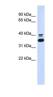 Western Blot EPHX4 Antibody - BSA Free
