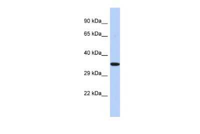 Western Blot: EPHX4 Antibody [NBP2-84860] - Host: Rabbit. Target Name: EPHX4. Sample Type: HepG2 Whole cell lysates. Antibody Dilution: 1.0ug/ml