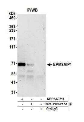 Immunoprecipitation: EPM2AIP1 Antibody [NBP2-60711] - Detection of human EPM2AIP1 by western blot of immunoprecipitates. Samples: Whole cell lysate (0.5 or 1.0 mg per IP reaction; 20% of IP loaded) from HeLa cells prepared using NETN lysis buffer. Antibodies: Affinity purified rabbit anti-EPM2AIP1 antibody NBP2-60711 used for IP at 20 ul per reaction. EPM2AIP1 was also immunoprecipitated by another rabbit anti-EPM2AIP1 antibody. For blotting immunoprecipitated EPM2AIP1, NBP2-60711 was used at 1:100. Detection: Chemiluminescence with an exposure time of 30 seconds.