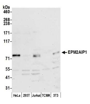 Western Blot: EPM2AIP1 Antibody [NBP2-60711] - Detection of human and mouse EPM2AIP1 by western blot. Samples: Whole cell lysate (15 ug) from HeLa, 293T, Jurkat, mouse TCMK-1, and mouse NIH3T3 cells prepared using NETN lysis buffer. Antibody: Affinity purified rabbit anti-EPM2AIP1 antibody NBP2-60711 used for WB at 1:1000. Detection: Chemiluminescence with an exposure time of 30 seconds.