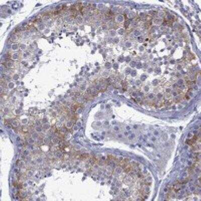 Immunohistochemistry-Paraffin: EPPIN-WFDC6 Antibody [NBP3-17970] - Staining of human testis shows strong cytoplasmic positivity in cells in seminiferous ducts.