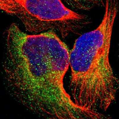 Immunocytochemistry/Immunofluorescence: EPS15 Antibody [NBP1-89221] - Immunofluorescent staining of human cell line U-2 OS shows localization to cytosol & vesicles.