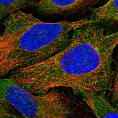 Immunocytochemistry/Immunofluorescence: EPS15 Antibody [NBP2-68773] - Staining of human cell line U-2 OS shows localization to cytosol & vesicles.