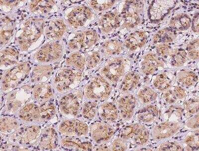 Immunohistochemistry-Paraffin: EPS15 Antibody [NBP3-12544] - Staining of human EPS15 in human stomach with rabbit polyclonal antibody at 1:500 dilution.