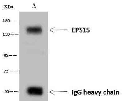 Immunoprecipitation: EPS15 Antibody [NBP3-12544] - Lane A:0.5 mg Jurkat Whole Cell Lysate4 uL anti-EPS15 rabbit polyclonal antibody and 60 ug of Immunomagnetic beads Protein A/G.Primary antibody:Anti-EPS15 rabbit polyclonal antibody,at 1:100 dilution Secondary antibody:Goat Anti-Rabbit IgG (H+L)/HRP at 1/10000 dilutionDeveloped using the ECL technique.Performed under reducing conditions.Predicted band size: 99 kDaObserved band size :150 kDa