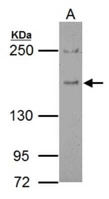 Western Blot: EPS15 Antibody [NBP2-16356] - Sample (30 ug of whole cell lysate) A: BCL-1 5% SDS PAGE gel, diluted at 1:500.