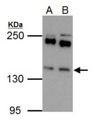 Western Blot: EPS15 Antibody [NBP2-16356] - Sample (30 ug of whole cell lysate) A: Raji B: K562 5% SDS PAGE gel, diluted at 1:1000.