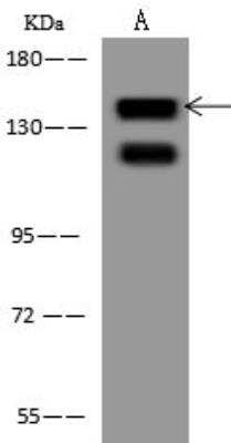 Western Blot: EPS15 Antibody [NBP3-12544] - Lane A: Jurkat Whole Cell LysateLysates/proteins at 30 ug per lane.SecondaryGoat Anti-Rabbit IgG (H+L)/HRP at 1/10000 dilution.Developed using the ECL technique.Performed under reducing conditions.Predicted band size:99 kDa(We are unsure as to the identity of these extra bands.)