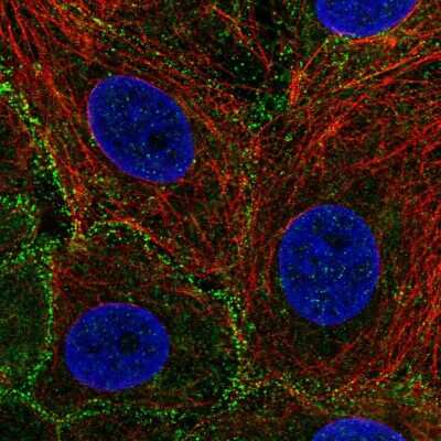 Immunocytochemistry/Immunofluorescence: EPS15R Antibody [NBP2-56664] - Staining of human cell line MCF7 shows localization to vesicles.