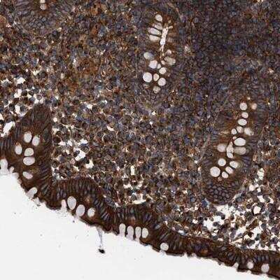 Immunohistochemistry-Paraffin: EPS15R Antibody [NBP1-84828] - Staining of human appendix shows strong cytoplasmic and membranous positivity in glandular cells.
