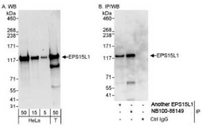 Western Blot EPS15R Antibody