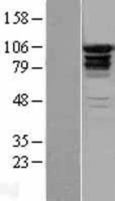 Western Blot: EPS15R Overexpression Lysate (Adult Normal) [NBL1-10302] Left-Empty vector transfected control cell lysate (HEK293 cell lysate); Right -Over-expression Lysate for EPS15R.