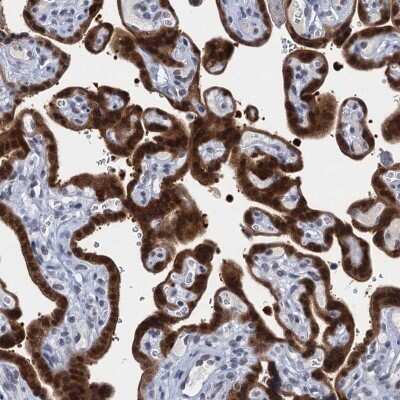 Immunohistochemistry: EPS8L1 Antibody [NBP2-32599] - Staining of human placenta shows strong positivity in trophoblastic cells.