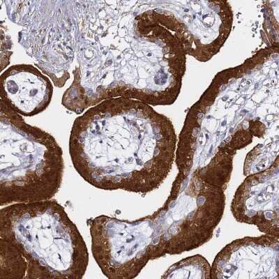 Immunohistochemistry: EPS8L1 Antibody [NBP2-33288] - Staining of human placenta shows strong positivity in trophoblastic cells.