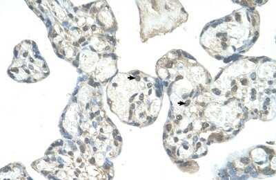 Immunohistochemistry-Paraffin: EPS8L1 Antibody [NBP1-56689] - Human Placenta Decidual cells (indicated with arrows), 4-8ug/ml.