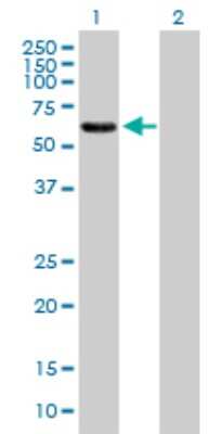 Western Blot: EPS8L1 Antibody [H00054869-B01P] - Analysis of EPS8L1 expression in transfected 293T cell line by EPS8L1 polyclonal antibody.  Lane 1: EPS8L1 transfected lysate(60.61 KDa). Lane 2: Non-transfected lysate.