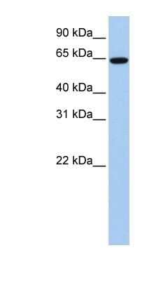 Western Blot EPS8L1 Antibody - BSA Free