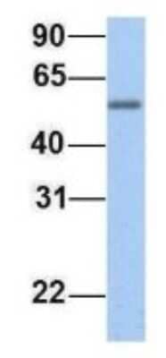 Western Blot EPS8L1 Antibody - BSA Free