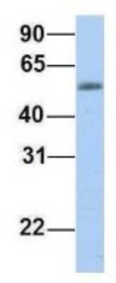 Western Blot: EPS8L1 Antibody [NBP1-56615] - Human Fetal Muscle, Antibody Dilution: 1.0 ug/ml.