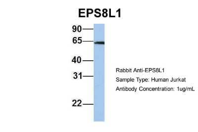 Western Blot: EPS8L1 Antibody [NBP1-56615] - Jurkat, Antibody Dilution: 1.0 ug/ml There is BioGPS gene expression data showing that EPS8L1 is expressed in Jurkat.
