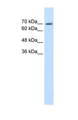 Western Blot: EPS8L1 Antibody [NBP1-56689] - HepG2 cell lysate, Antibody Titration: 1.25ug/ml