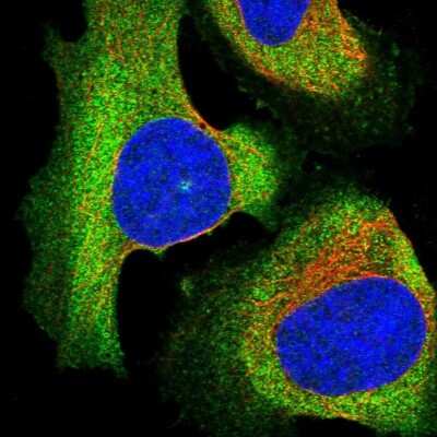 Immunocytochemistry/ Immunofluorescence EPS8L2 Antibody - BSA Free