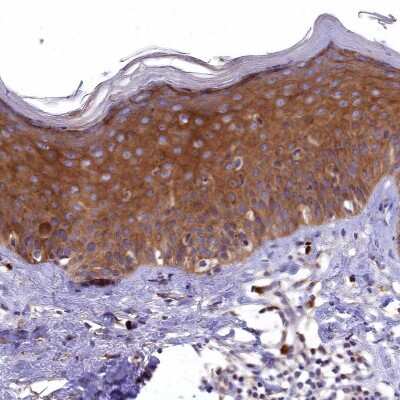 Immunohistochemistry-Paraffin: EPS8L2 Antibody [NBP1-83613] - Staining of human skin shows strong cytoplasmic positivity in epidermal cells.