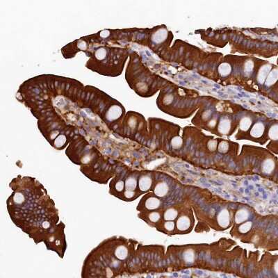Immunohistochemistry-Paraffin: EPS8L2 Antibody [NBP1-83613] - Staining of human small intestine shows strong cytoplasmic positivity in glandular cells.