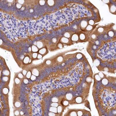 Immunohistochemistry-Paraffin: EPS8L2 Antibody [NBP1-83613] - Staining of human duodenum shows strong cytoplasmic positivity in glandular cells.