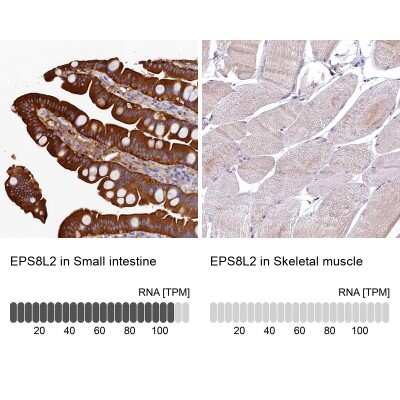 <b>Orthogonal Strategies Validation. </b>Immunohistochemistry-Paraffin: EPS8L2 Antibody [NBP1-83613] - Staining in human small intestine and skeletal muscle tissues.. Corresponding EPS8L2 RNA-seq data are presented for the same tissues.