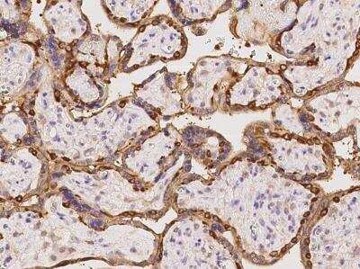 Immunohistochemistry-Paraffin: EPS8L2 Antibody [NBP3-06508] - Staining of human EPS8L2 in human placenta with rabbit polyclonal antibody at 1:500 dilution. 
