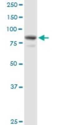 Western Blot: EPS8L2 Antibody [H00064787-B01P] - Analysis of EPS8L2 expression in A-431.