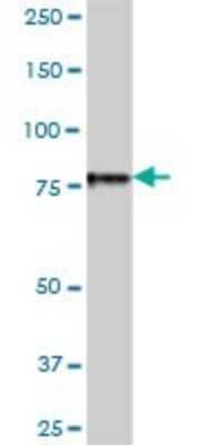 Western Blot: EPS8L2 Antibody [H00064787-B01P] - Analysis of EPS8L2 expression in human liver.
