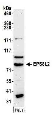 Western Blot: EPS8L2 Antibody [NB100-97850] - Detection of Human EPS8L2 by Western Blot. Samples: Whole cell lysate (50 ug) from HeLa cells prepared using NETN lysis buffer. Antibody: Affinity purified rabbit anti-EPS8L2 antibody NB100-97850 used for WB at 0.1 ug/ml. Detection: Chemiluminescence with an exposure time of 3 minutes.