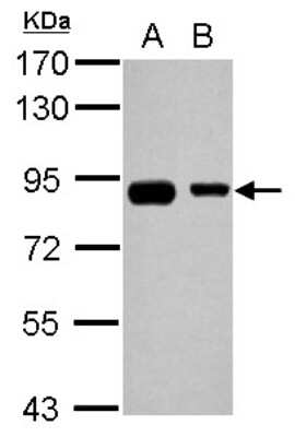 Western Blot: EPS8L2 Antibody [NBP2-16357] - Sample (30 ug of whole cell lysate) A: A431 B: HepG2 7. 5% SDS PAGE gel, diluted at 1:1000.